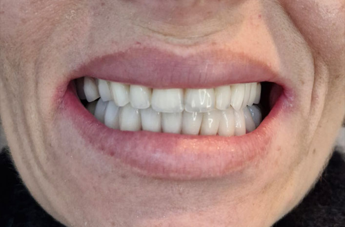 Antes e Depois 2
