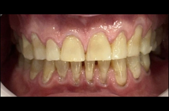 Antes e Depois 3